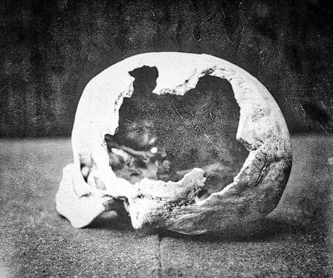 Abby-Borden-skull