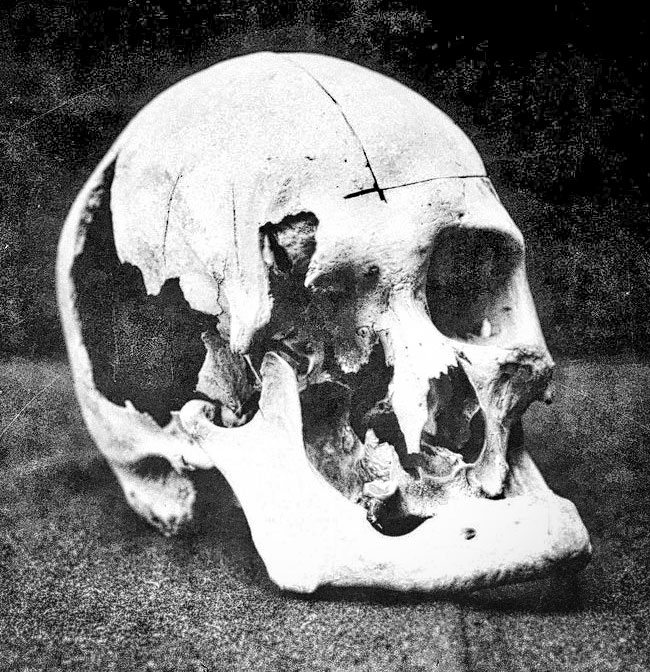Andrew-Borden-skull